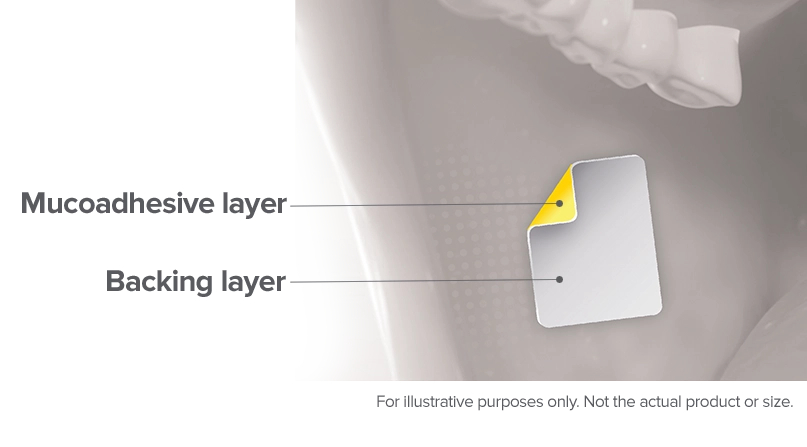 image of the backing layer and mucoadhesive layers of a the Belbuca buccal film